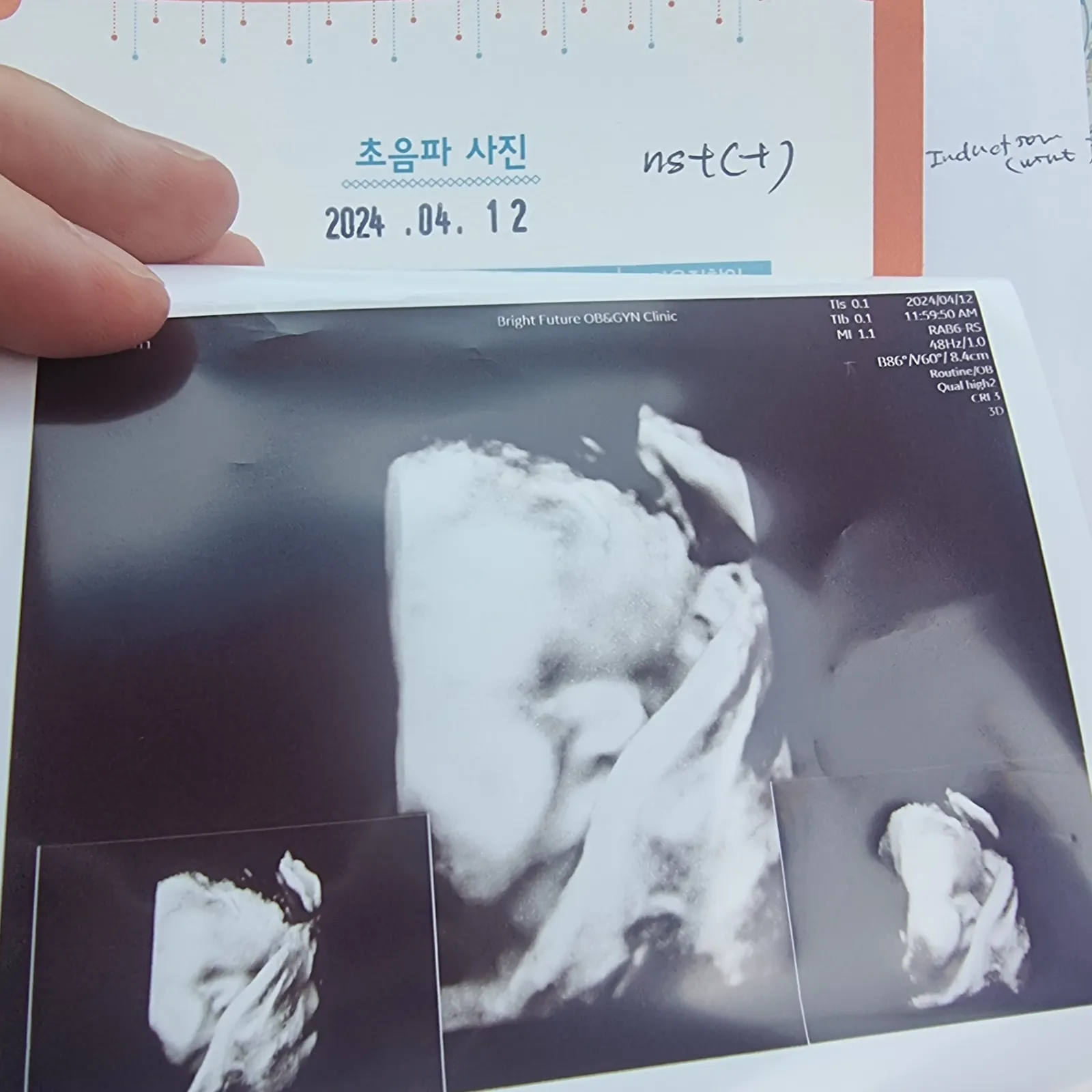 만삭 임산부 40주 차….. 의 단상